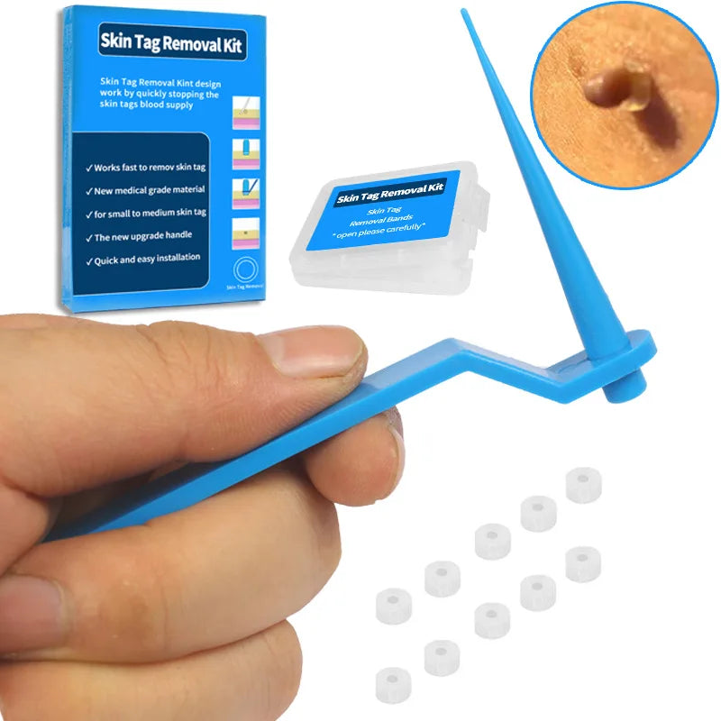 1 Set Skin Tag Removal Kit Skin Mole Wart Remover Micro Band Skin Tag Removal Kit Tag Treatment Tools Set Beauty Tools For 1-5mm