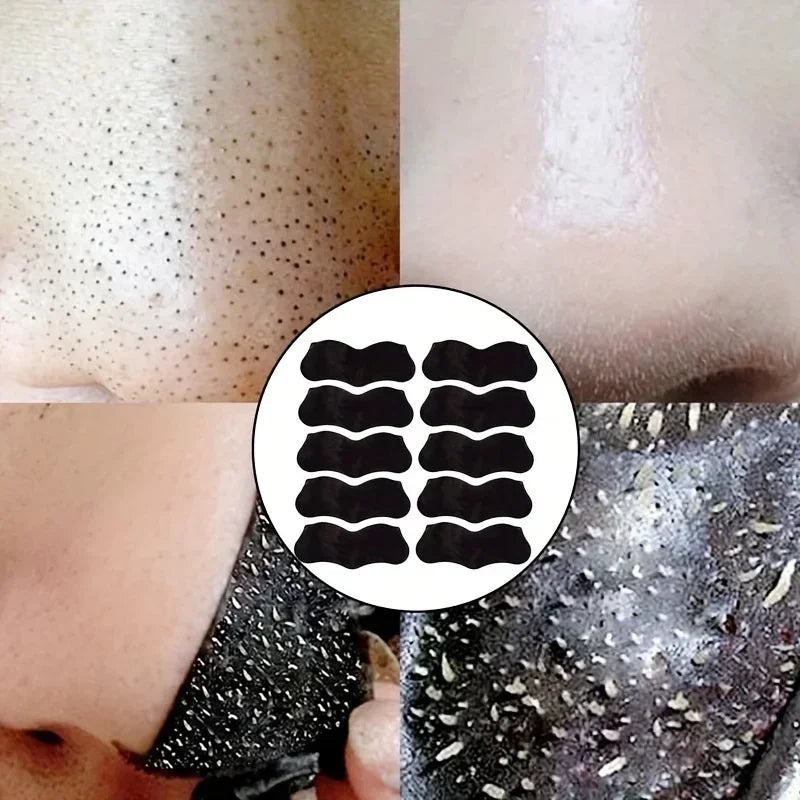10-100pcs Blackhead Nose Strips Deep Cleansing Nasal Spot Facial Dot Stickers Nose Mask Shill For Acne & Black Head - Dropship