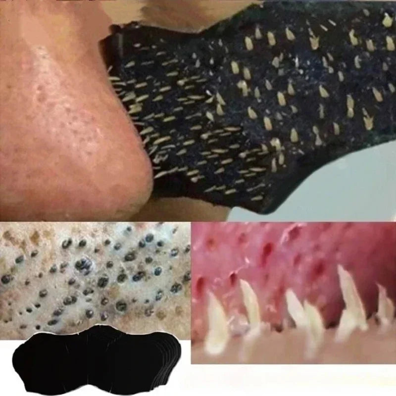 Deep Cleansing Pore Shrinking Stickers | Effective Blackhead Remover for Nose & Face | Skin Care Patch for Clearer Skin