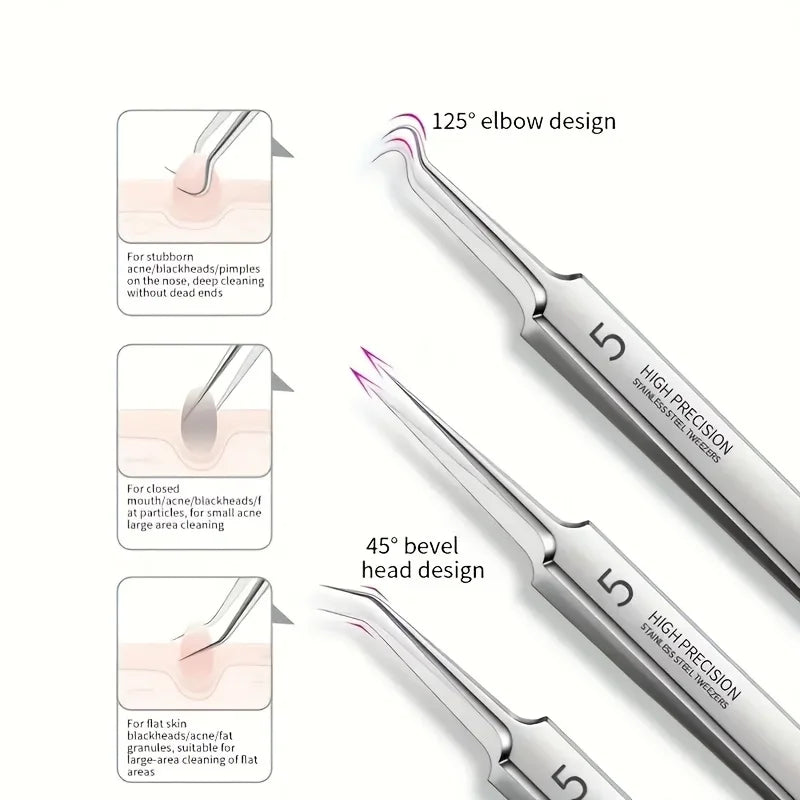 1/3pcs Extra Fine No. 5 Cellular Acne Blackhead Tweezers,Facial Beauty Remove Acne Needle Tools for Skin Care,Blackhead clip