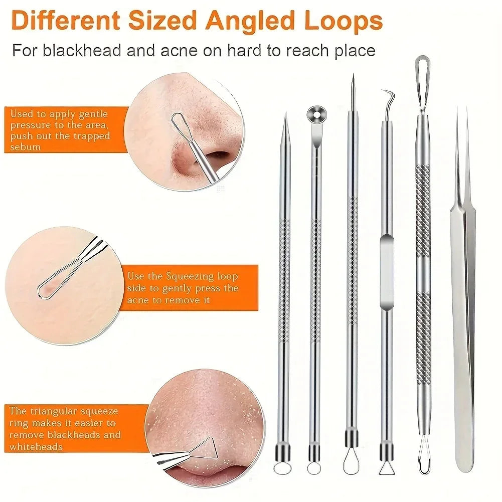 6Pcs Ultra-Precise Pimple Tweezers Set - Pro Acne and Blackhead Removal Tool -for Effective Face Care and Skin Purification