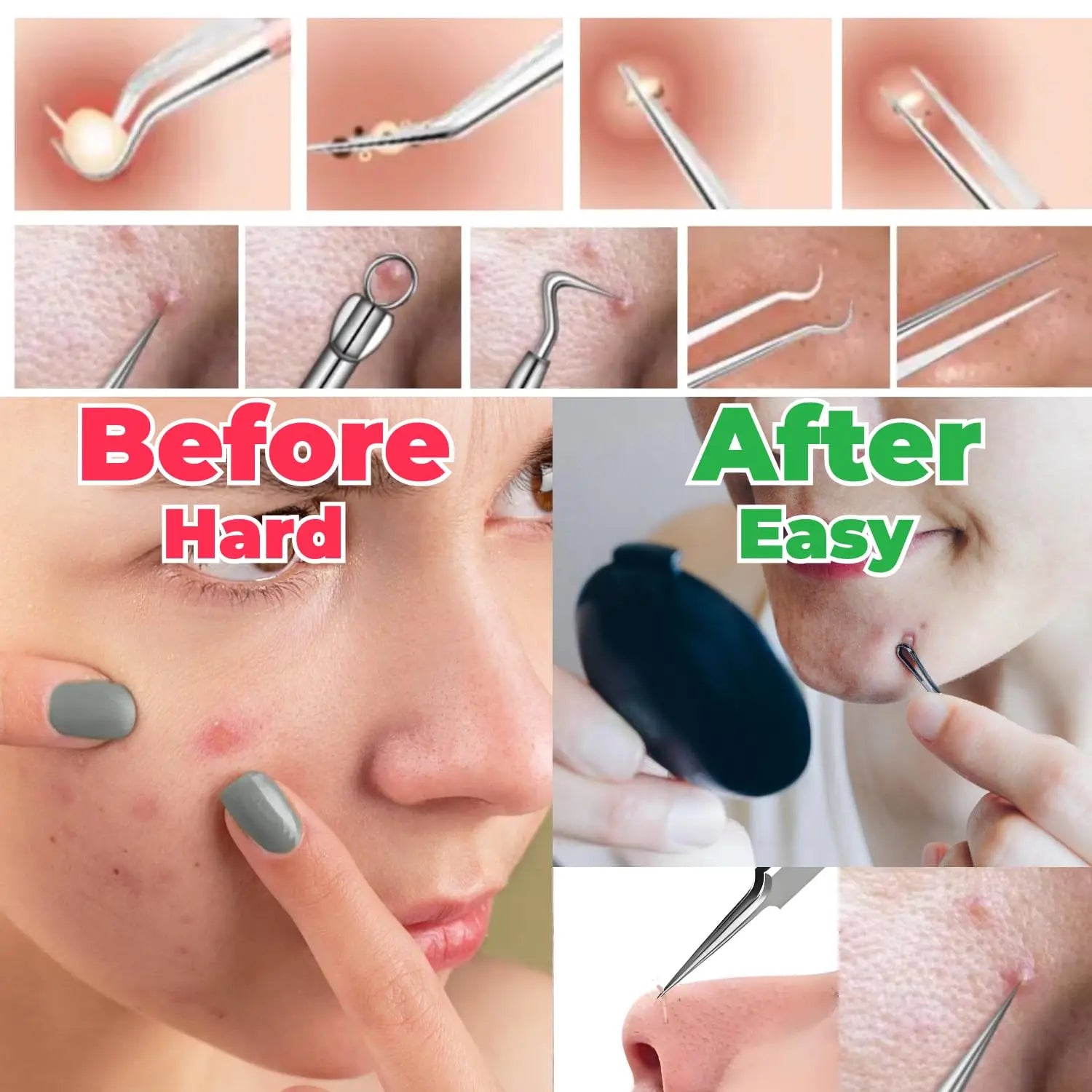 1/8Pcs PcCell Pimples Blackhead Remover Clip Ultra-fine Tweezers Black Dots Blackhead Extractor Acne Needle Facial Cleaner Skin