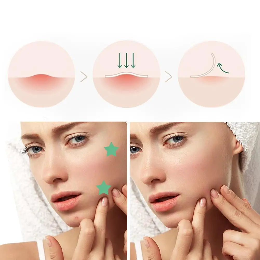 300/600pcs Star Acne Patch Mild Non-irritating Lightens Acne Hydrocolloid Acne Sticker For Blackheads Closed Comedones