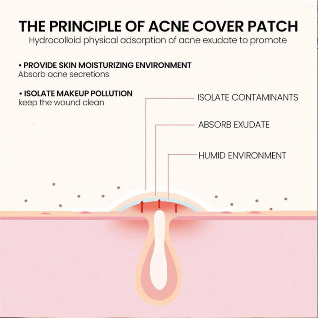 Acne Patch- Star shaped Acne Patch That Can Shrink Pimples Whiteheads With Just One Use Facial And Skin Night Spot (200pcs/ 1B0X