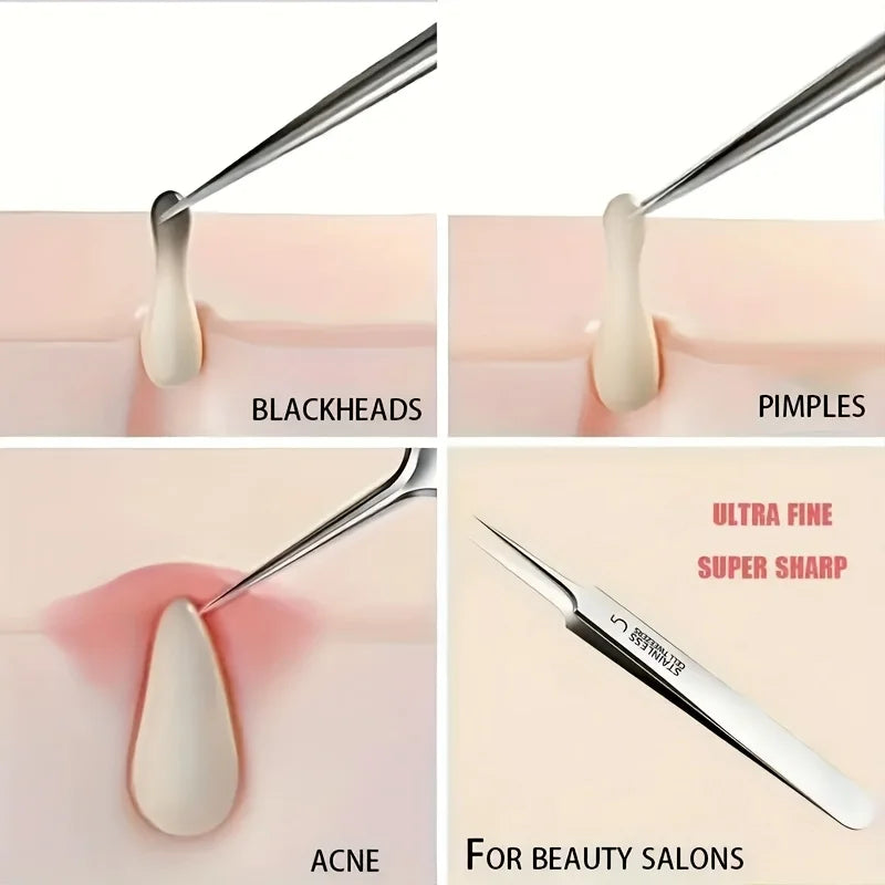 1/3pcs Extra Fine No. 5 Cellular Acne Blackhead Tweezers,Facial Beauty Remove Acne Needle Tools for Skin Care,Blackhead clip