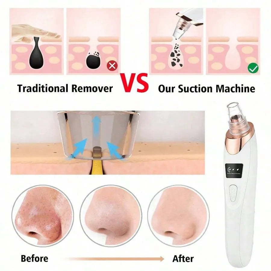 5 Suction Power Blackhead Remover Pore Vacuum,Women Blackhead Remover Pore Vacuum,FacialPoreCleaner Kit For Adult ExtractorTool
